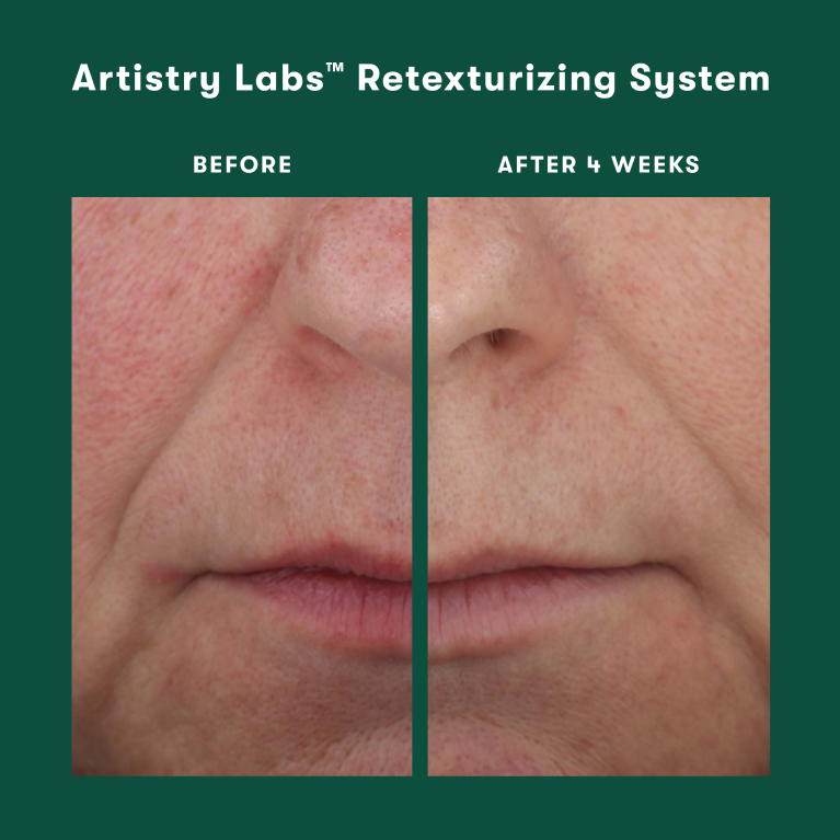 Before and after of a mature woman’s skin after using the Artistry Labs Retexturizing System. First image features her skin before using the Retexturizing System, next to her image after 4 weeks of use.